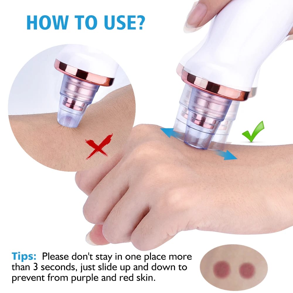 5 in 1 Blackhead remover | Derma Suction  | Rechargeable