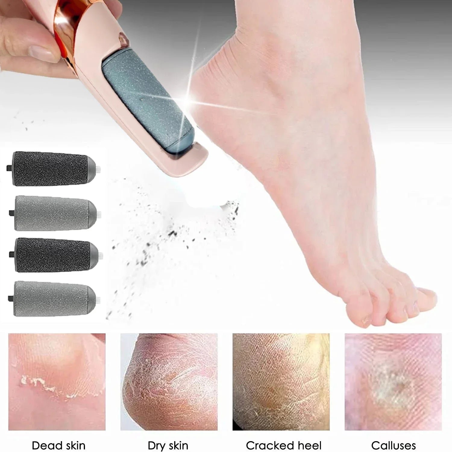 Foot File Callus - Image 5